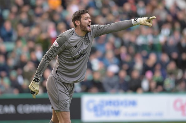 Celtic look a much better side without Craig Gordon in goals