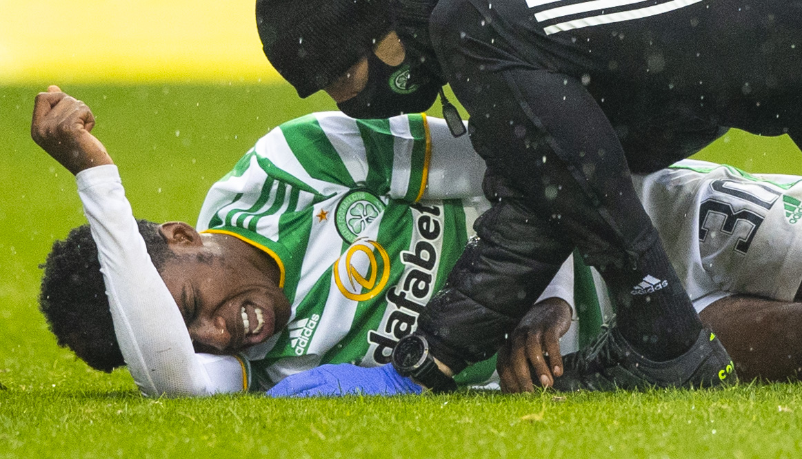 Celtic star Jeremie Frimpong suffered a nasty knock vs Motherwell