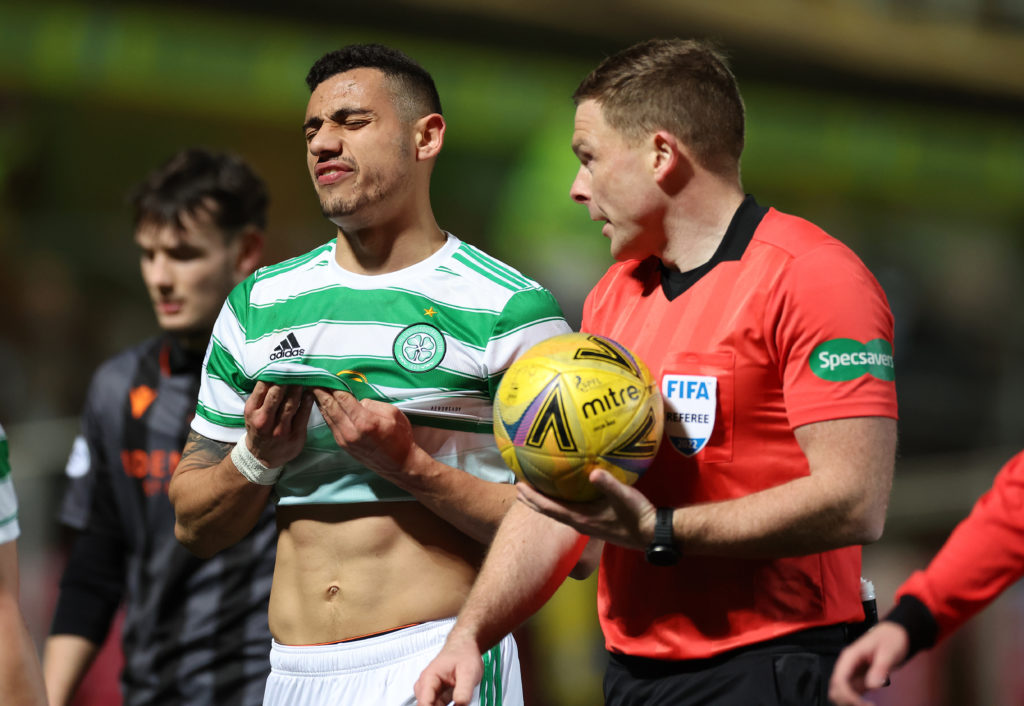 Dundee United FC v Celtic FC - Scottish Cup Sixth Round
